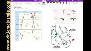 LBBB and RBBB left VS right bundle branch block Dr Jamal USMLE  Cardiology ECG lecture [upl. by Niles]