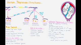 Multiple Pregnancy Twins Triplets  Zygosity Chorionisity Amnionisity Risks Delivery [upl. by Ranchod268]