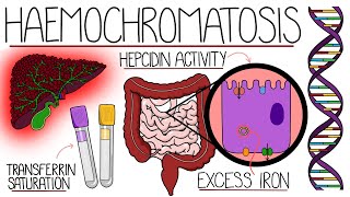 Understanding Haemochromatosis Hereditary amp Secondary [upl. by Safko907]