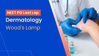 NEETPG Prep  Dermatology  Woods Lamp by Dr Shimona [upl. by Aikrehs]