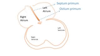 interatrial Septum development [upl. by Linc665]