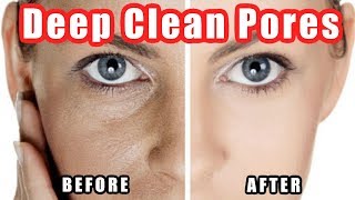 How to Clean Pores  Deep Cleaning Your Pores on Nose  Face Easily [upl. by Valenza]