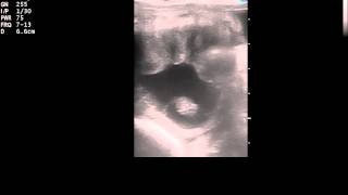 Ultrasound of a 26 day equine pregnancy [upl. by Bigelow]