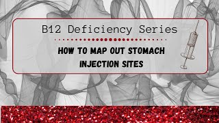 Mapping Out Subcutaneous Injection Sites on Stomach [upl. by Rechaba223]