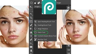 Face Dark Spots Remove  Photopea photo editing  Patch Tool [upl. by Eirdua960]