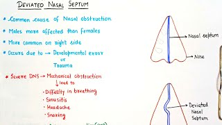 Deviated Nasal Septum [upl. by Chouest647]