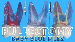 Pulpectomy ⚪️ Baby Blue Pediatric Rotary Endodontic Files 🔵 Simulated Demonstration [upl. by Selhorst]