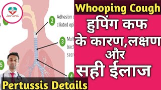 Whooping Cough  Pertussis हुपिंग कफ किसे हो सकता है ईलाज क्या है पूरी जानकारी। [upl. by Imhsar106]