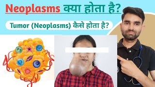 Neoplasm in Hindi  Neoplasm Kya Hota Hai  Neoplasm Kya Hai [upl. by Matthei485]