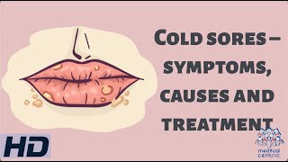 Cold Sores – Symptoms Causes and Treatment [upl. by Lamphere976]