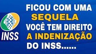 MUITOS SEGURADOS TEM DIREITO É NÃO SABEM o que fazer pra conseguir [upl. by Yursa]