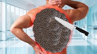 ASMR Trypophobia infected back treatment  ASMR Animation treatment video 2danimation [upl. by Mclyman]