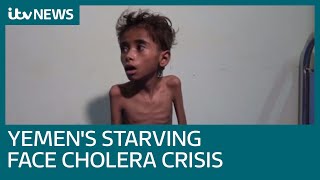 Yemens starving now face worlds worst cholera outbreak  ITV News [upl. by Sigler]