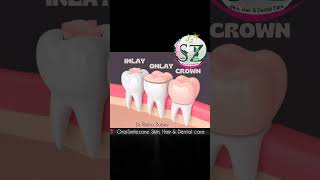 Various stages of dental problems and solutions shortsfeed drrichadubey drorai drtreatment [upl. by Atrahc]