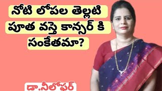 Leukoplakia Telugu Oral Cancer Precancerous Lesions Leukoplakia Symptoms Leukoplakia Causes [upl. by Ramedlab]