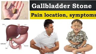 Gallbladder stones symptoms  What is gallbladder  stone pain location area in hindi  urdu [upl. by Pederson]