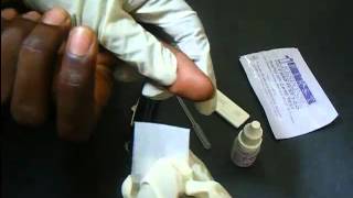 HIV Antibody Test Using A Rapid HIV Card [upl. by Singband]