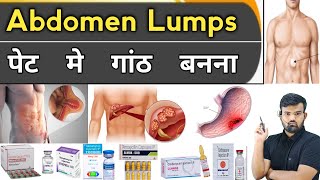 Abdomen Lumps  पेट में गांठ बनना  Medicine  Treatment  Pharmacy  Hospital  Doctor  Nursing [upl. by Aikehs]