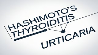 Understanding the Link Between Chronic Spontaneous Urticaria and Thyroid Health [upl. by Kat556]