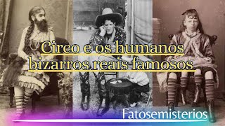 Circo e os humanos com deformidades reais que ficaram famosos [upl. by Earleen]