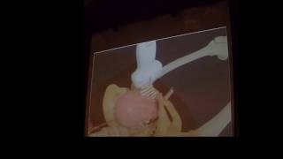 BASIC FETAL BIOMETRY [upl. by Roderigo]