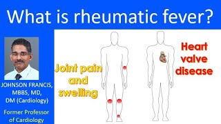 What is rheumatic fever [upl. by Anoo]