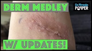 Derm Medley with Updates DerMedUpdates [upl. by Eniamrej]