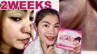 BRILLIANT SKIN REJUVENATING SET  IWASAN ANG Kati Hapdi PAMUMULA TIPS  HONEST REVIEW NO TO SUNOG [upl. by Wey]