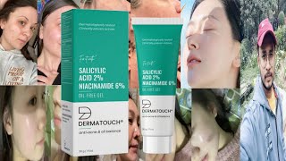 Dermatouch Salicylic Acid Niacinamide Oil Free Gel  Honest Review [upl. by Nus]