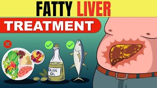 Reduce Your Liver Fat by 50 Percent in 14 Days [upl. by Ieppet]