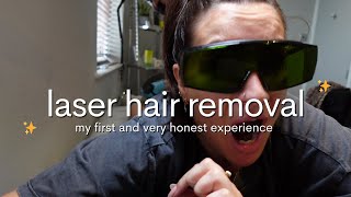 My honest laser hair removal experience come along with me for the real deal [upl. by Venezia]