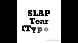 SLAP Tear Type 3 [upl. by Gabbie717]