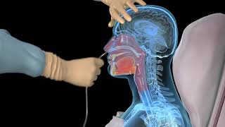 How to insert a nasogastric tube for NG intubation  3d animation [upl. by Vadnee]