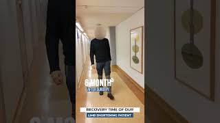 Recovery time of our limb shortening patient [upl. by Ttej]