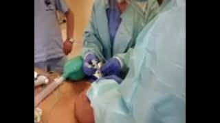 Airway Management During a Difficult Intubation Case [upl. by Akital828]