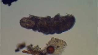 Tardigrade  Water Bear or Moss Piglet [upl. by Godwin758]