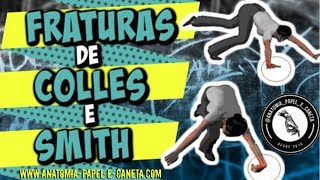 Fraturas de COLLES e SMITH [upl. by Jonie663]