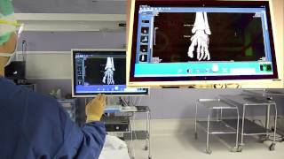 Kinect in operating room [upl. by Oab228]