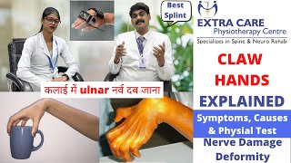 CLAW HAND EXPLAINED in Hindi  Nerve Damage Deformity  Ulnar and Median Nerve Injury [upl. by Asreht81]