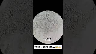 Pimples at 400X magnification are really cool underthemicroscope beefcut scienceshorts [upl. by Iridissa]