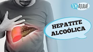 HEPATITE ALCOÓLICA E CIRROSE SINTOMAS DIAGNÓSTICO E TRATAMENTO [upl. by Mazman7]