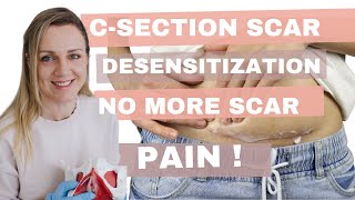 Csection scar desensitization no more scar pain Tips for better Csection recovery [upl. by Endora]