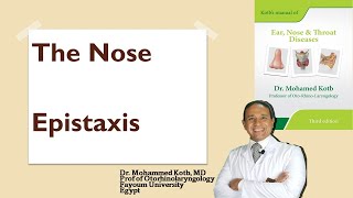 The nose Epistaxis causes amp management Professor Dr Mohamed Qotb [upl. by Joub425]