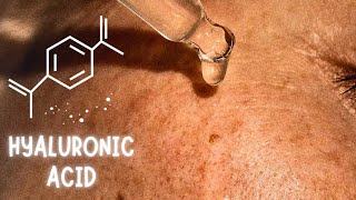 Does Hyaluronic Acid Really Works [upl. by Artek]