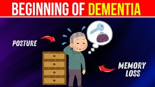 Dont Ignore Recognize Early Dementia Symptoms [upl. by Antonina]