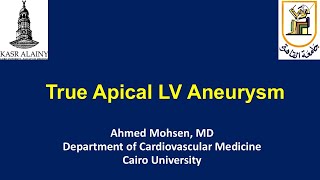 True Apical LV aneurysm [upl. by Trisa702]