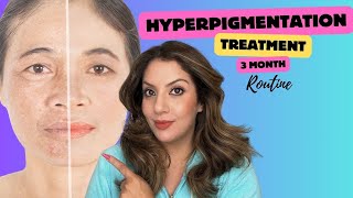 Hyperpigmentation treatment at home  Nipun Kapur [upl. by Arlinda203]