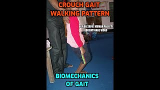 Crouch gait walking Pattern Cerebral Palsy gait Biomechanics Of Gait cycle Educational Video [upl. by Kono]