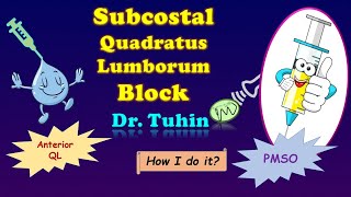 Subcostal QL Block I Anterior Quadratus Lumborum block  Subcostal Approach I Modified Subcostal QLB [upl. by Nereen358]