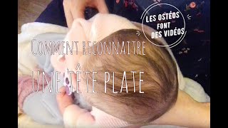 Comment reconnaitre une déformatione crânienne du bébé plagiocéphalie  brachycéphalie  tête plate [upl. by Cinomod]